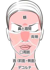 フラクショナルCo2レーザー