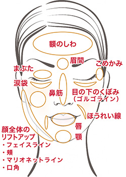 ヒアルロン酸 適応部位