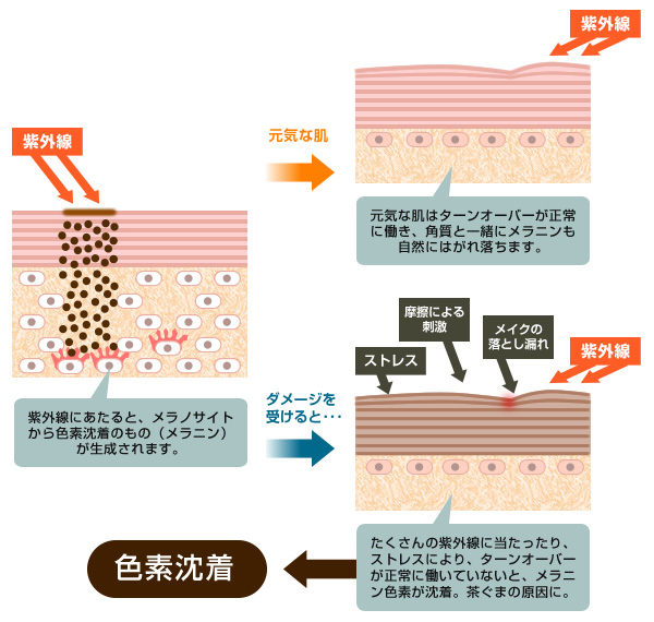 くまの原因 茶ぐま