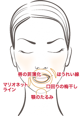 口周辺コンビネーションセラピー 施療部位