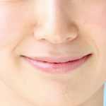 たるみがおこりやすい部分 ほうれい線