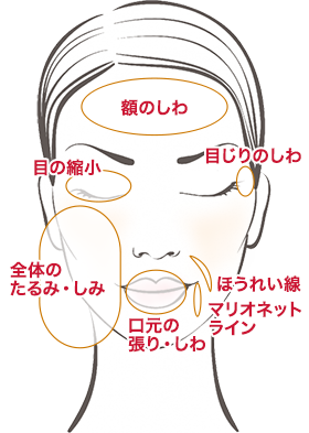 顔全体コンビネーションセラピー 施療部位
