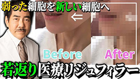 【施術映像有】肌トラブルにお悩みの方必見！リジュフィラー（プチ肌再生）の施術ついて、専門医が解説いたします！